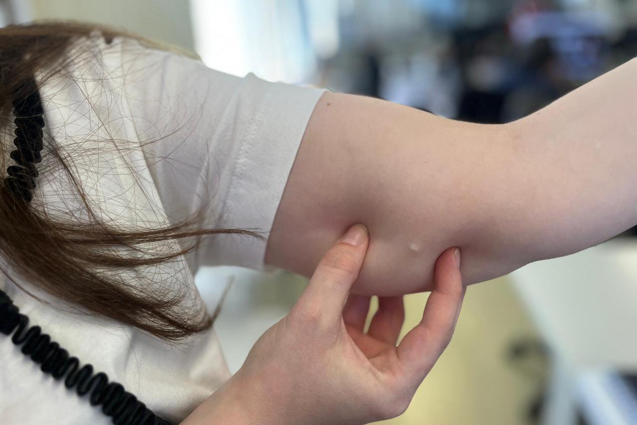 Implante contraceptivo de até R$ 4 mil chega gratuitamente ao SUS no PR