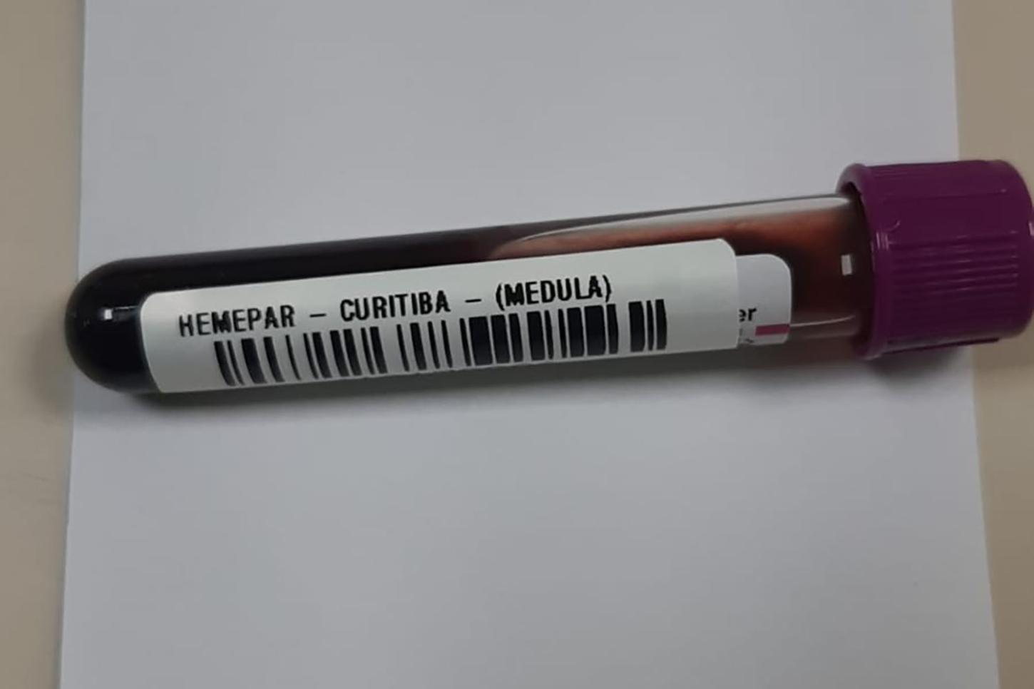 Leucemia se manifesta no sangue